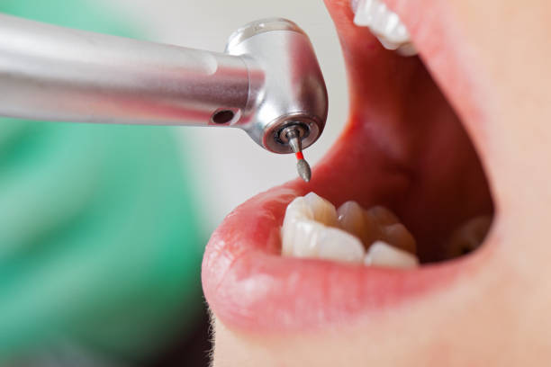 Best Pediatric Emergency Dentist in Quitman, TX